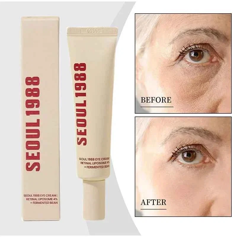 Smooth Seoul 1988 Retinol Eye Cream 4 Anti Aging Eye Treatment for Dark Circles Wrinkles Puffiness Artisan